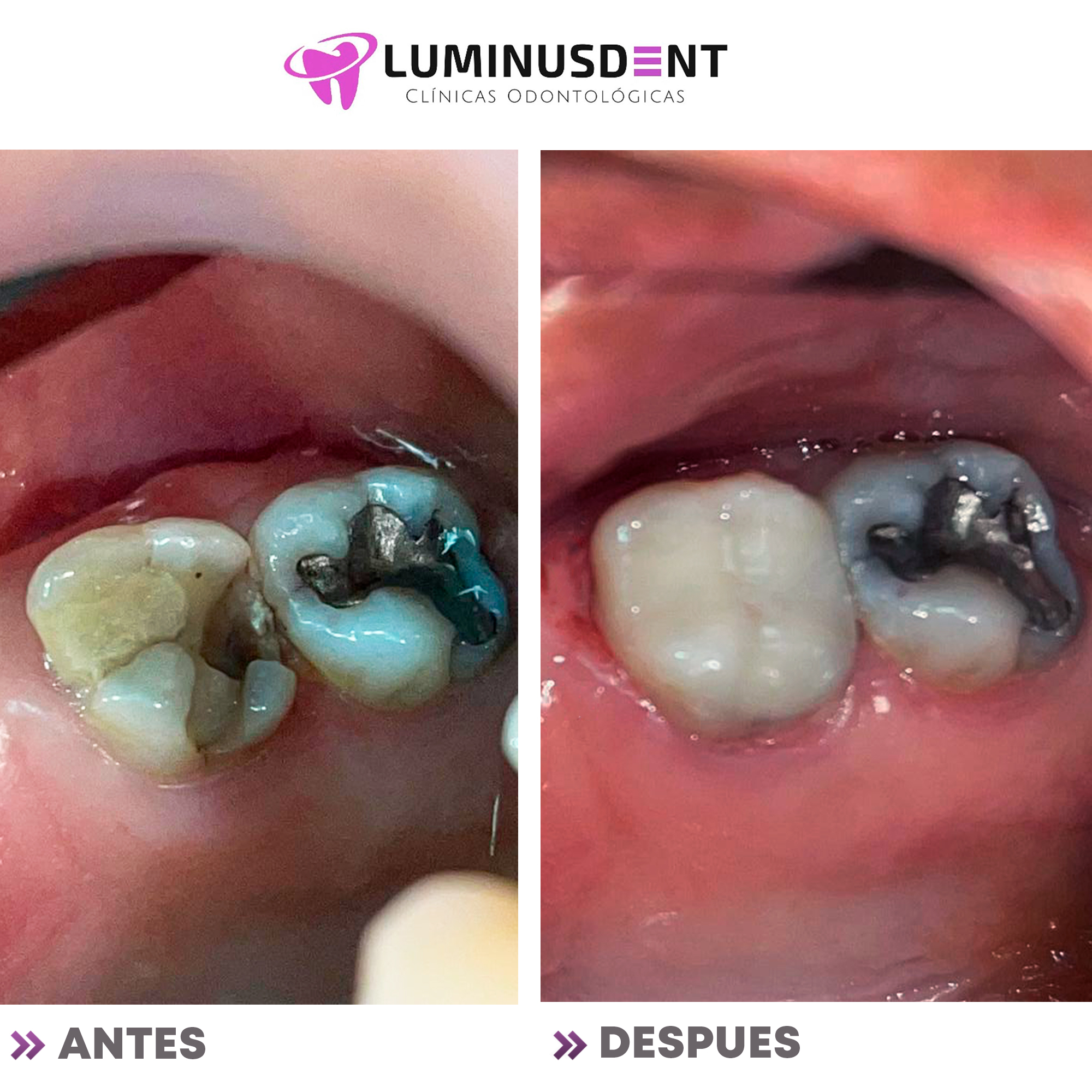 antes y depues