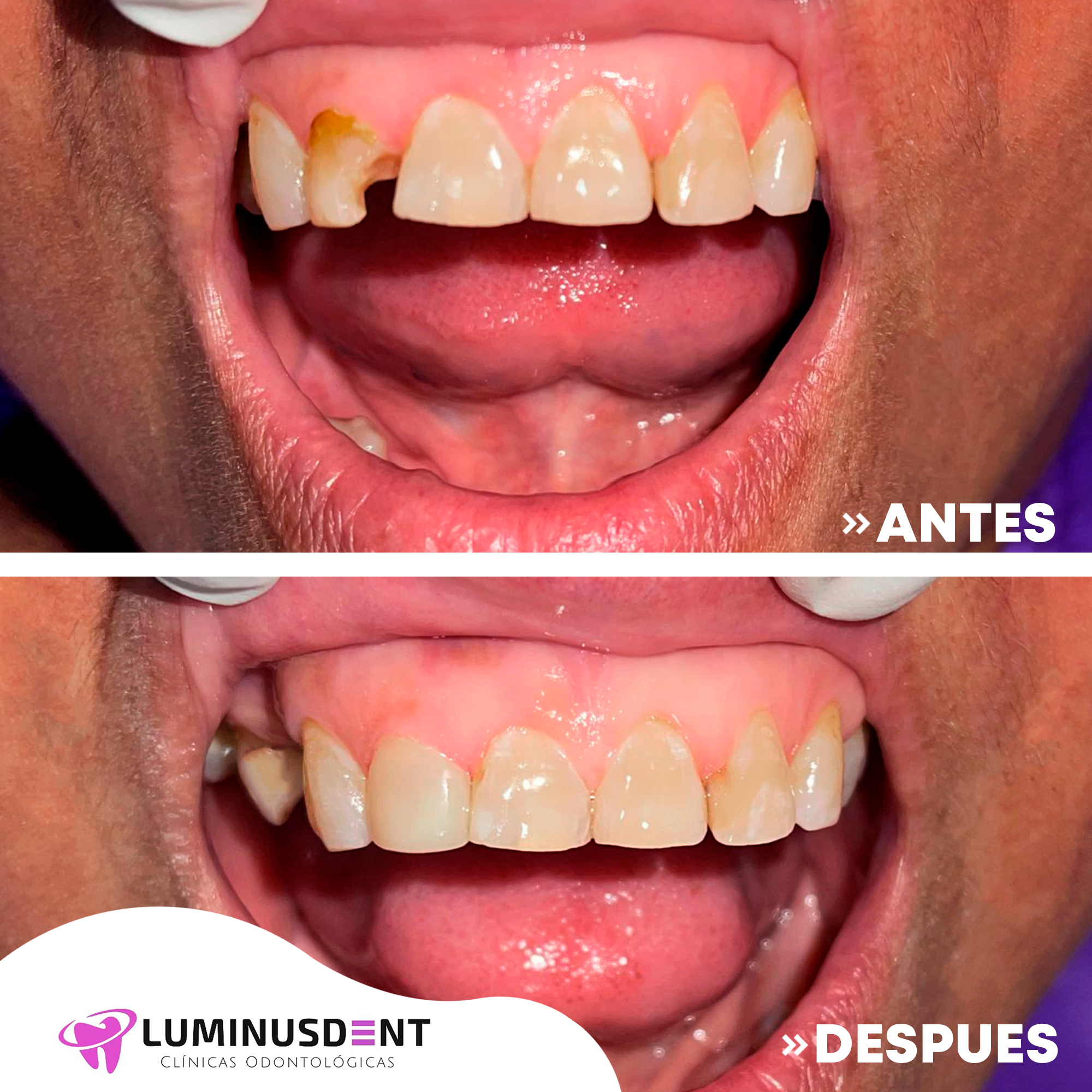 antes y despues enero 9