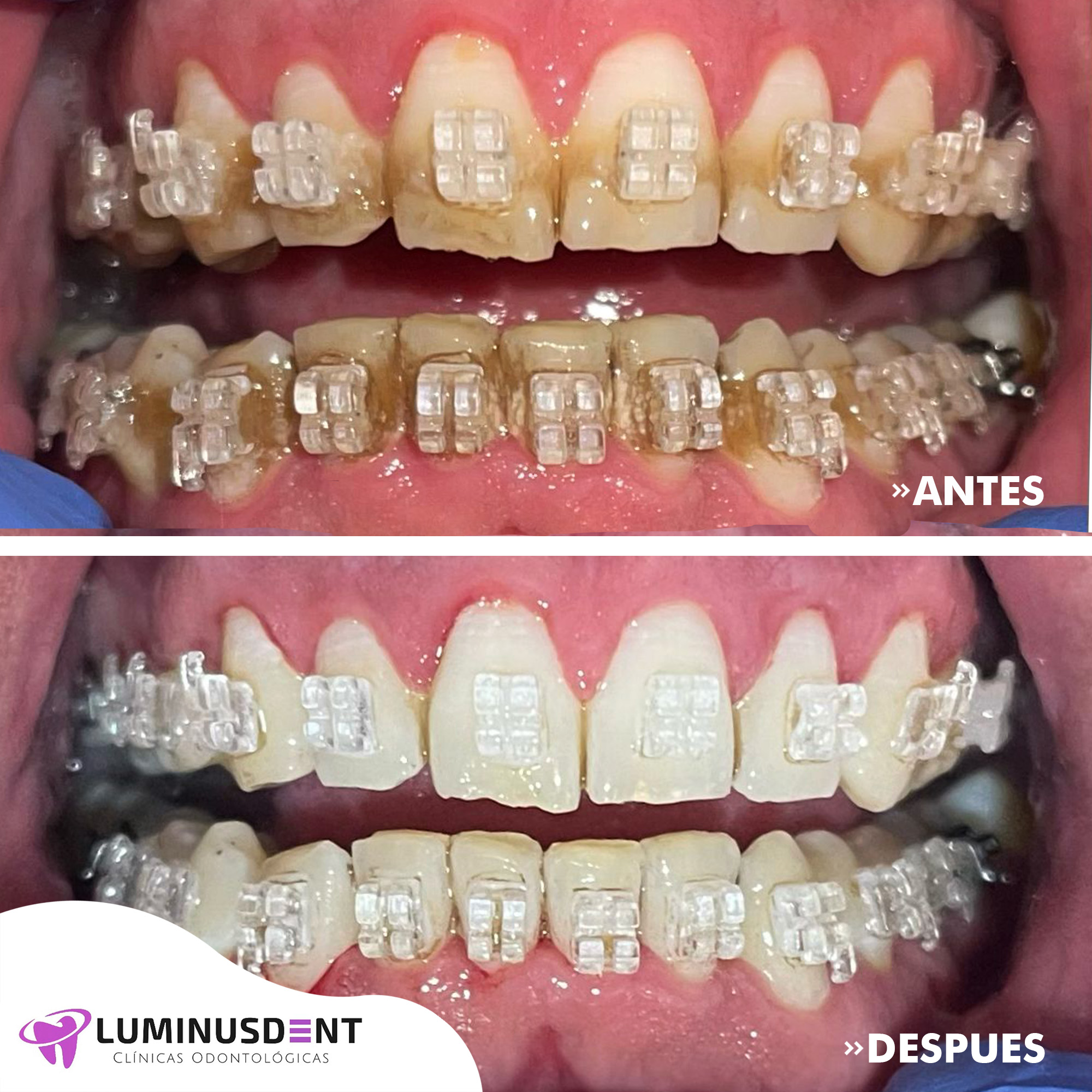 antes y despues septiembre