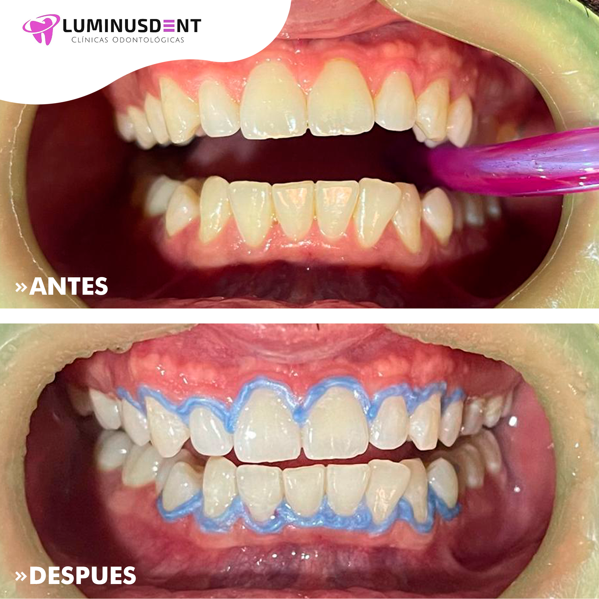 antes y despues